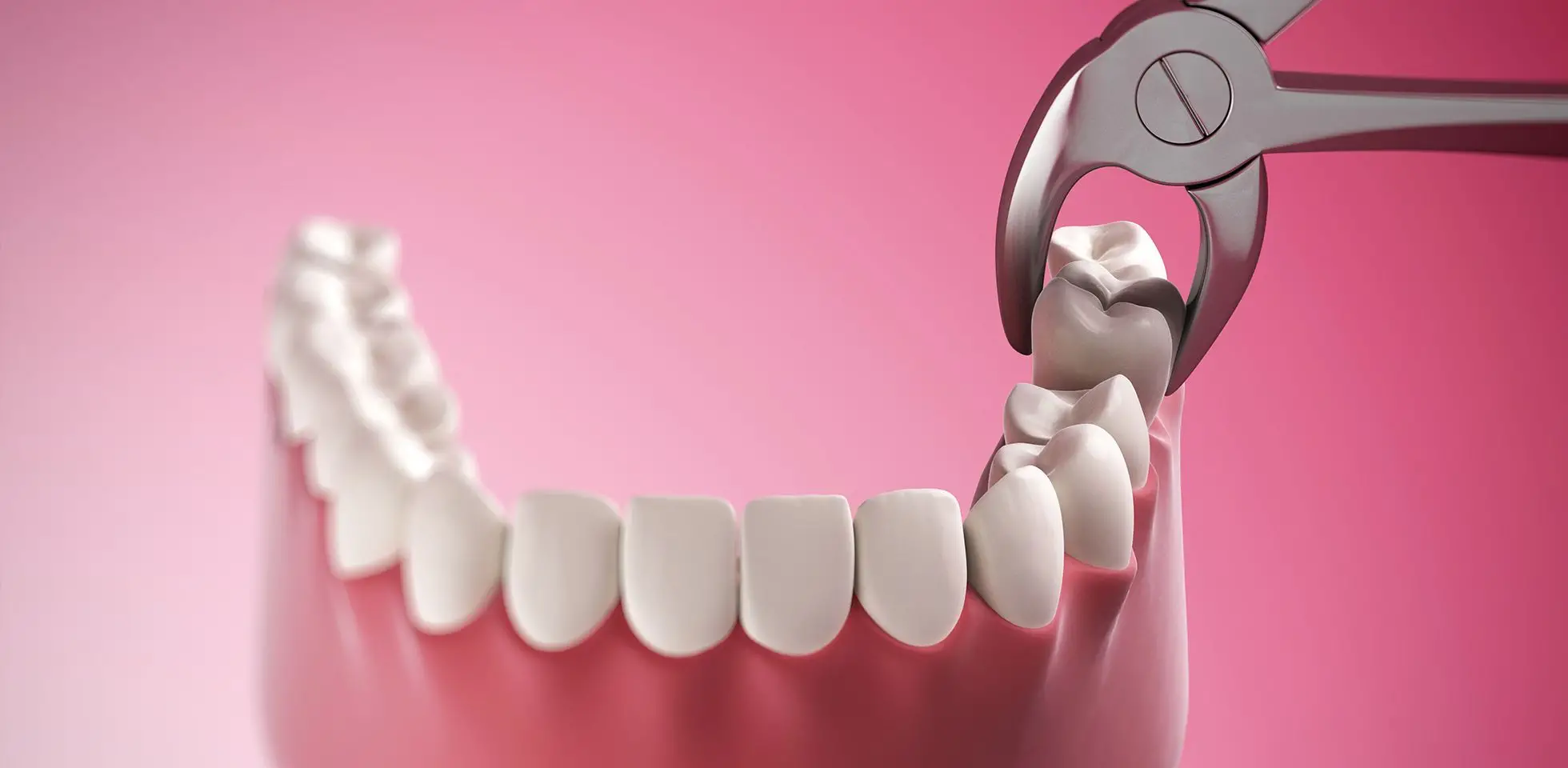 Oral Surgery NYC | Wisdom Teeth, Jaw Surgery & TMJ Treatment