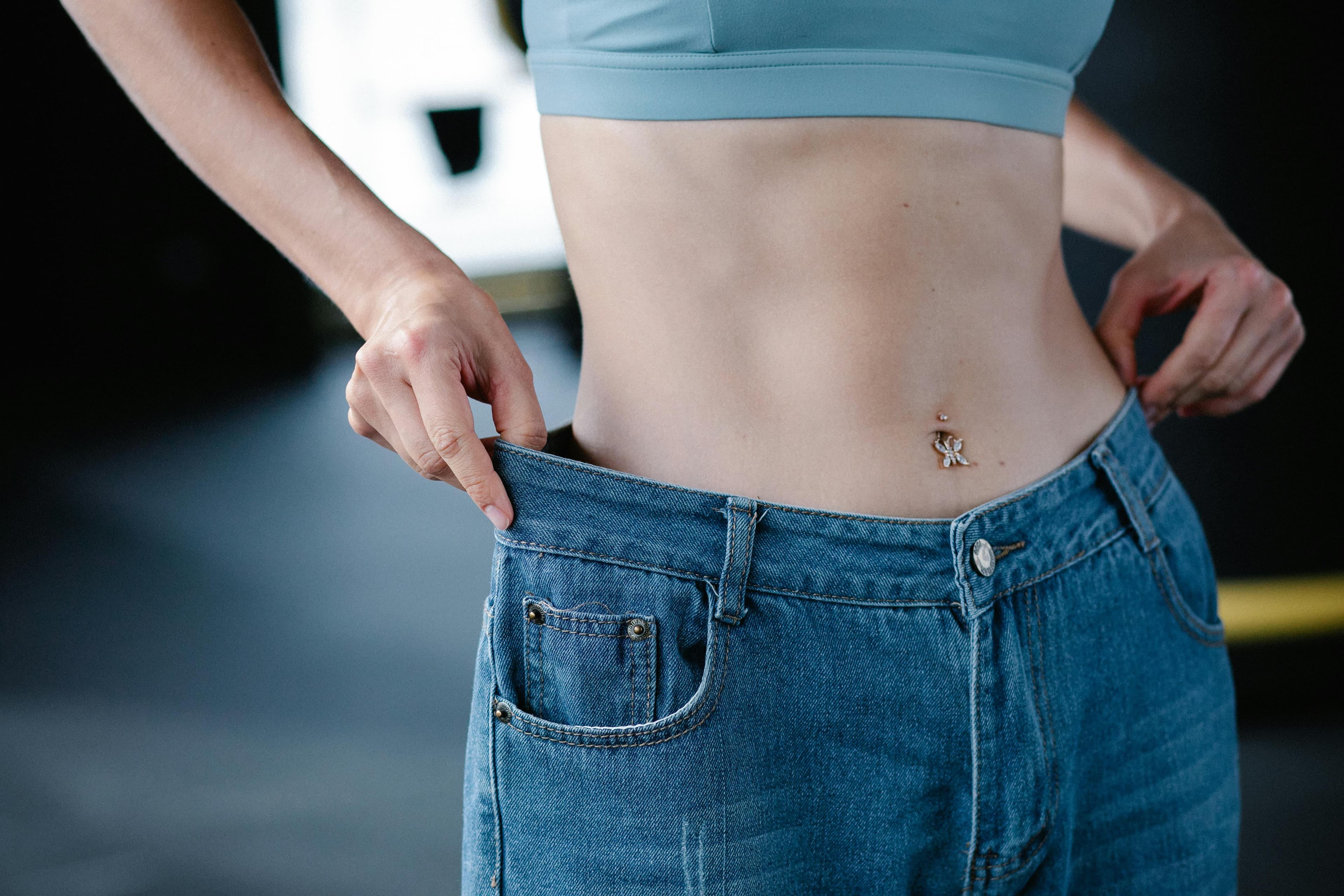 Stretch Marks: Causes, Prevention, and Effective Treatment Options