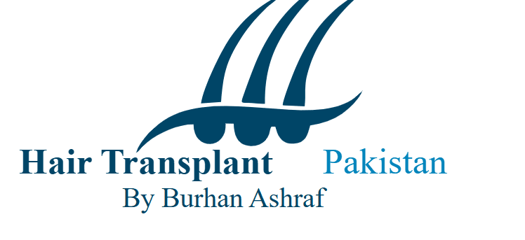 hair transplant in Pakistan