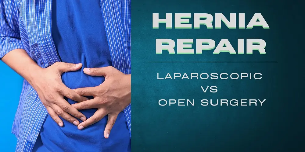 Hernia Repair: Laparoscopic vs Open Surgery