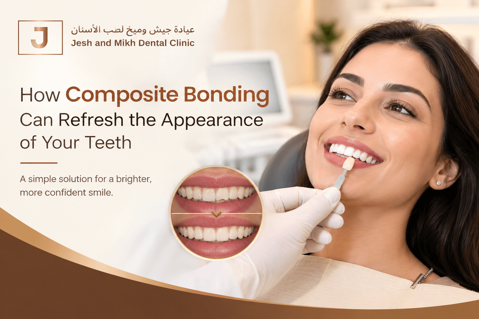 Composite Bonding for a More Confident Smile: What Patients Should Know