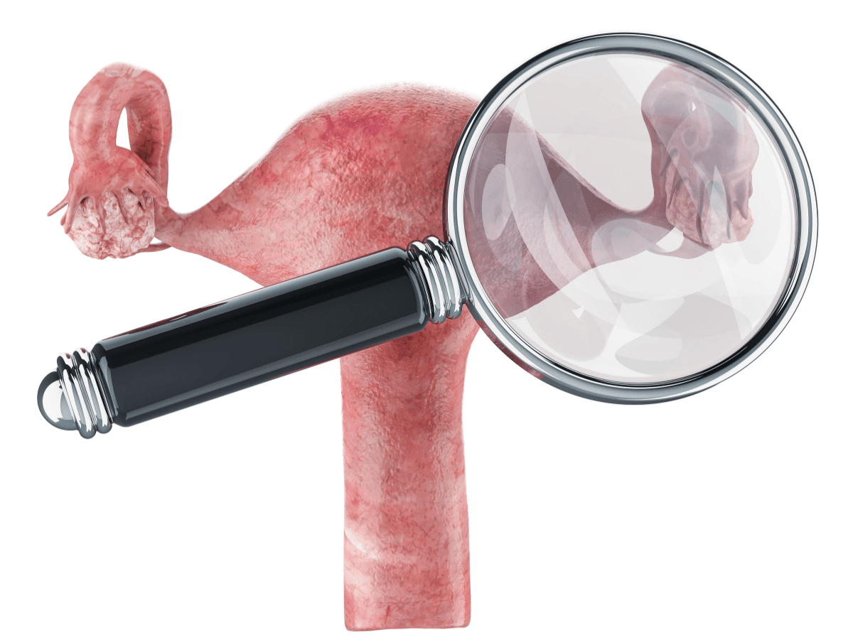 Ovarian Cysts Explained by Specialists at the Top Gynecology Hospital in Jalgaon