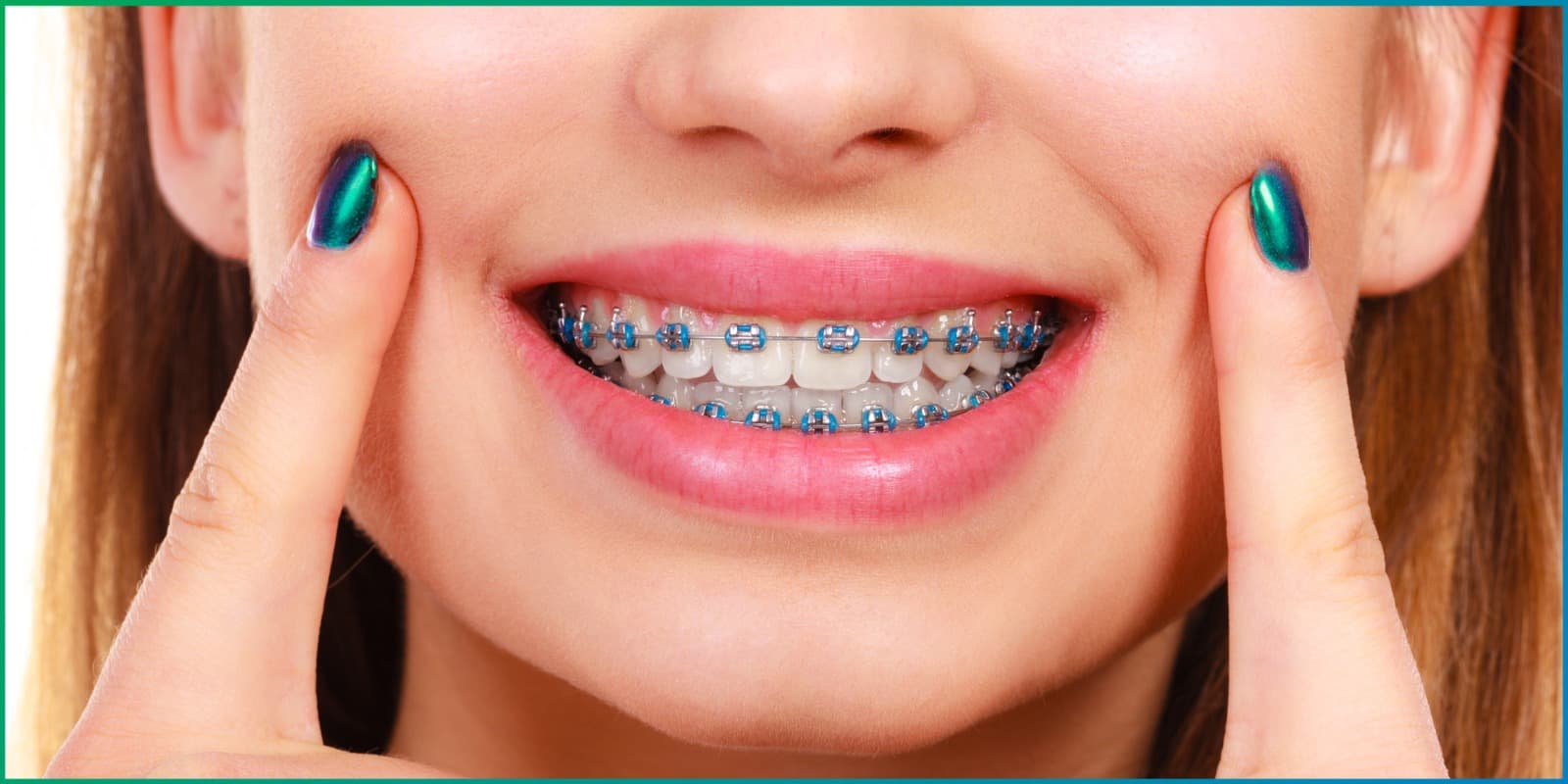 Are Dental Implants Safe? Expert Insights on Dental Implant Safety