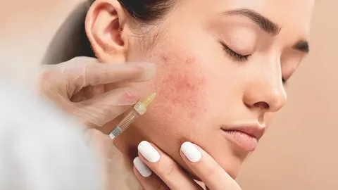 Pimples Treatment in Dubai | Clear Skin Solutions & Acne Care