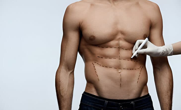 Complete Guide to 6 Pack Abs Surgery