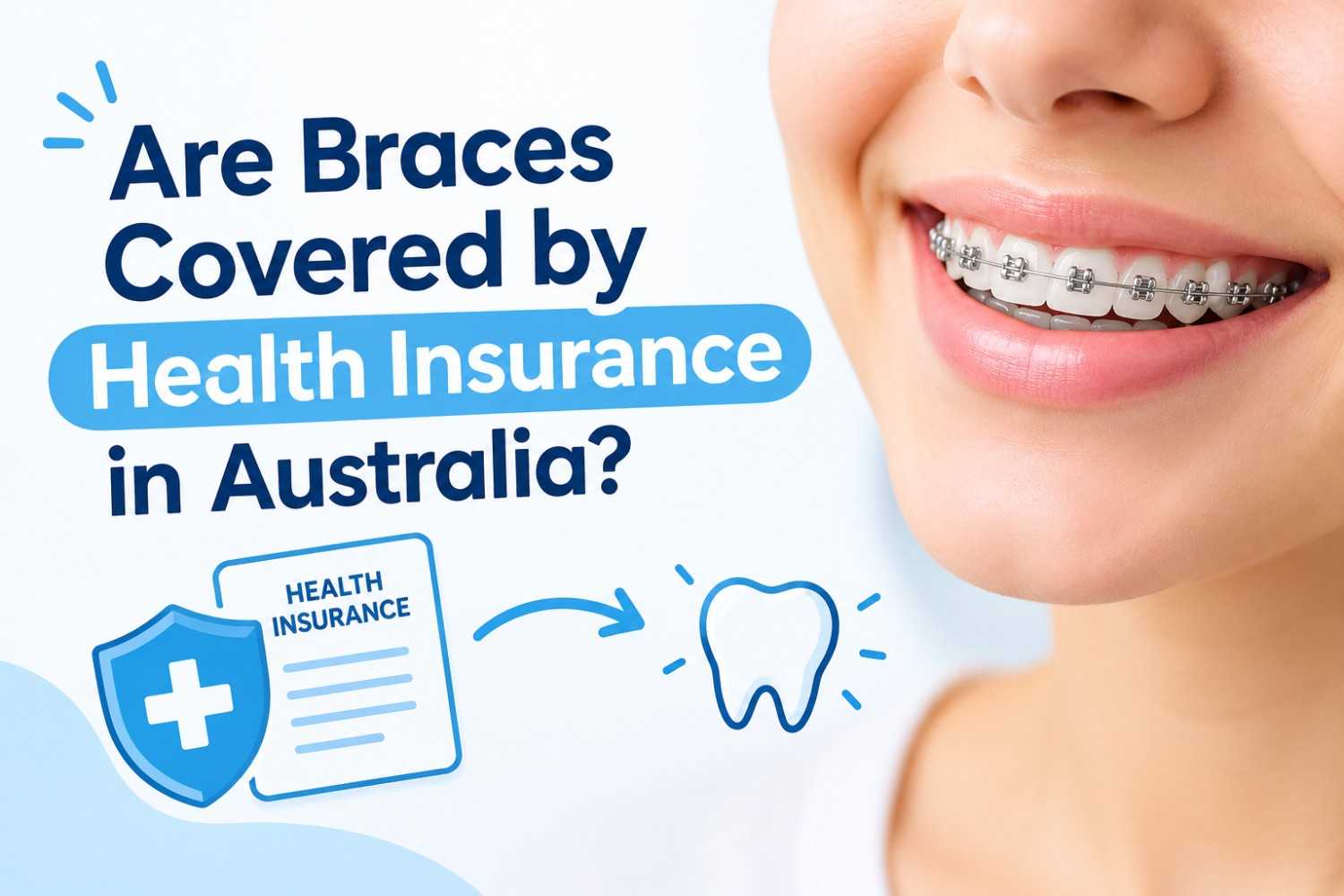 Are Braces Covered by Health Insurance in Australia?