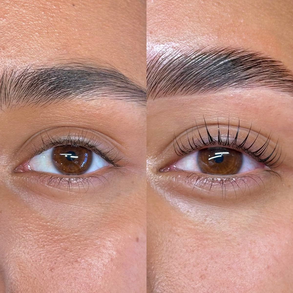 Eyelash Hair Restoration in Dubai | Natural Results