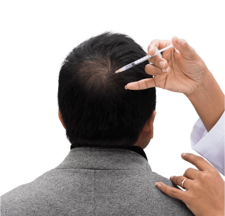 Hair Transplant in Dubai | Restore Your Natural Hair