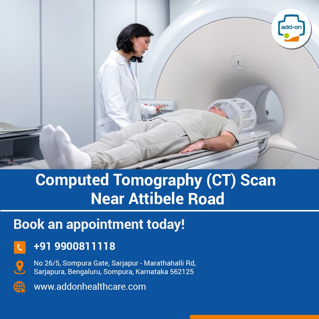 Computed Tomography (CT) Scan Near Attibele Road
