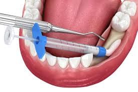 kids dentist in San Antonio tx
