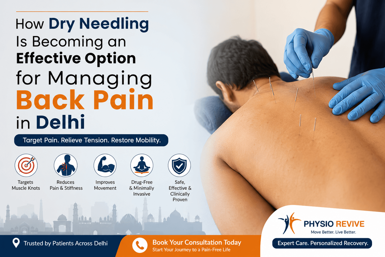 Dry Needling center in Delhi