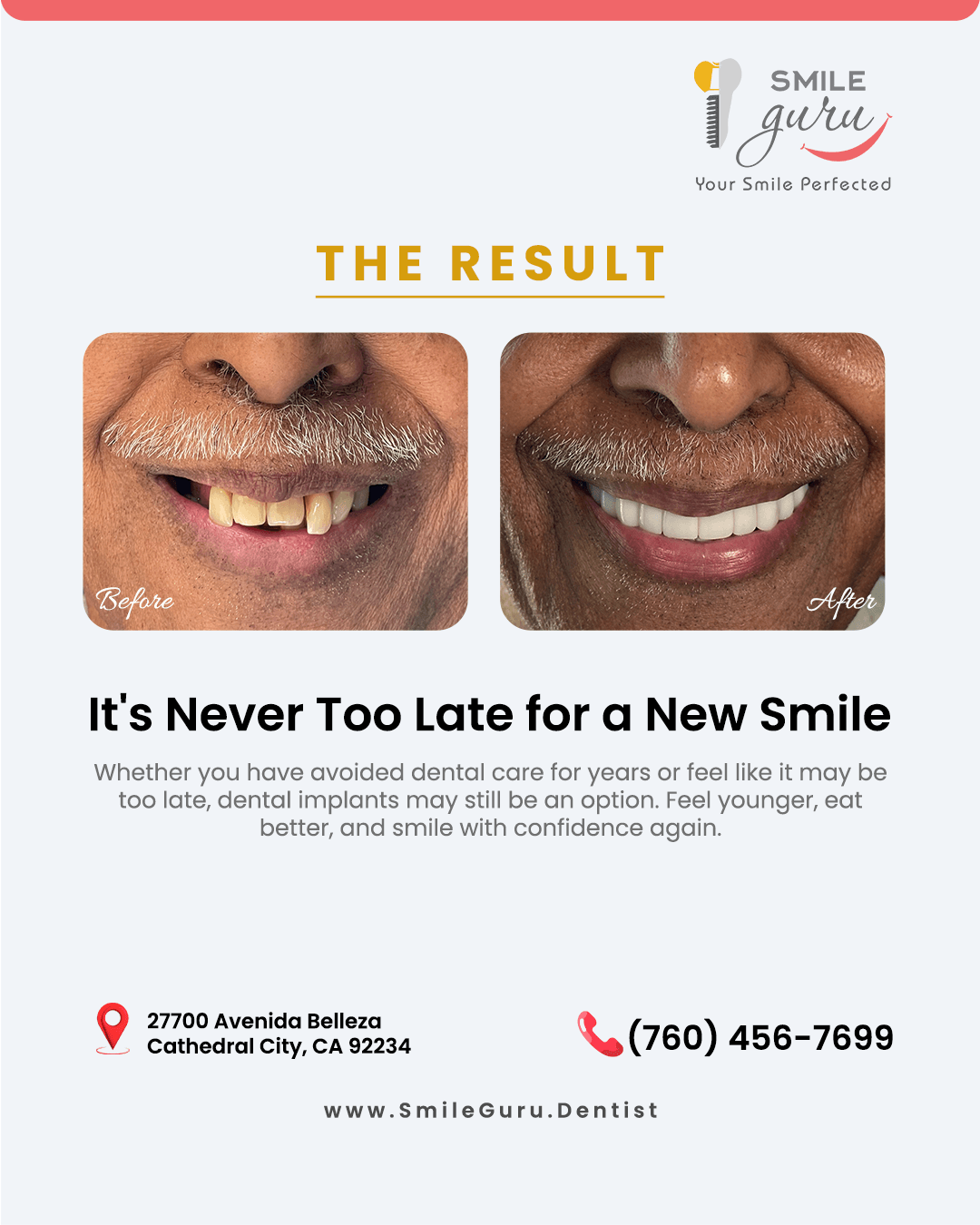 Dental Implants Can Restore Confidence at Any Age