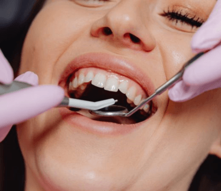 The Best Options for Affordable Cosmetic Dentistry Treatments