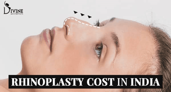 What Is Rhinoplasty? and Cost