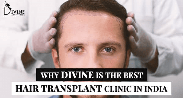 Best hair transplant clinic in India