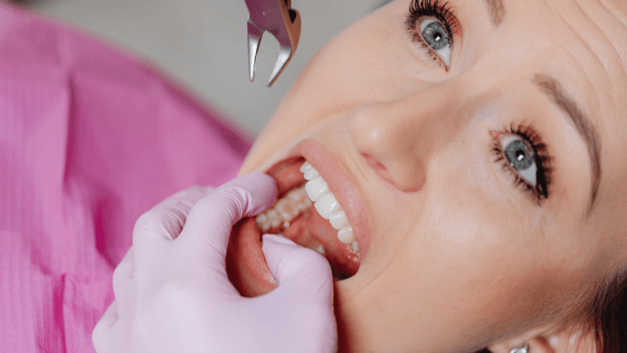 Understanding the Different Types of Tooth Extractions: Simple vs. Surgical