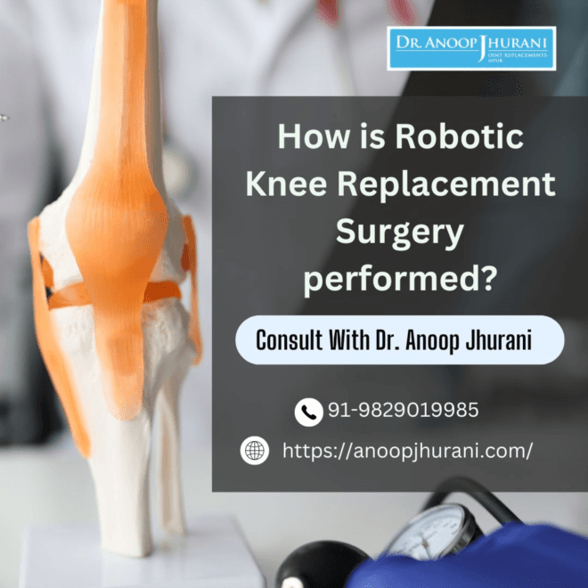 Robotic Knee Replacement: Precision in Knee Surgery