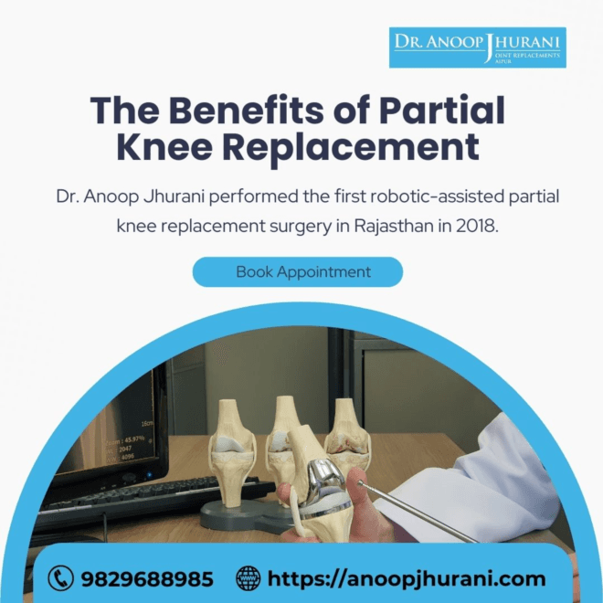Benefits of Partial Knee Replacement
