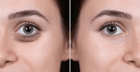 Fillers in Dubai: Enhancing Features with Medical Grade Care