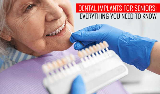 Dental Implants for Seniors - Everything You Need to Know