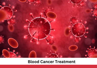 Blood Cancer Treatment
