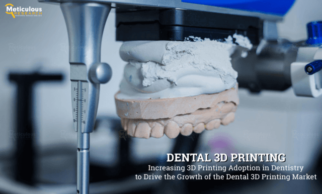 Dental 3D Printing Market to be Worth $13.4 Billion by 2030