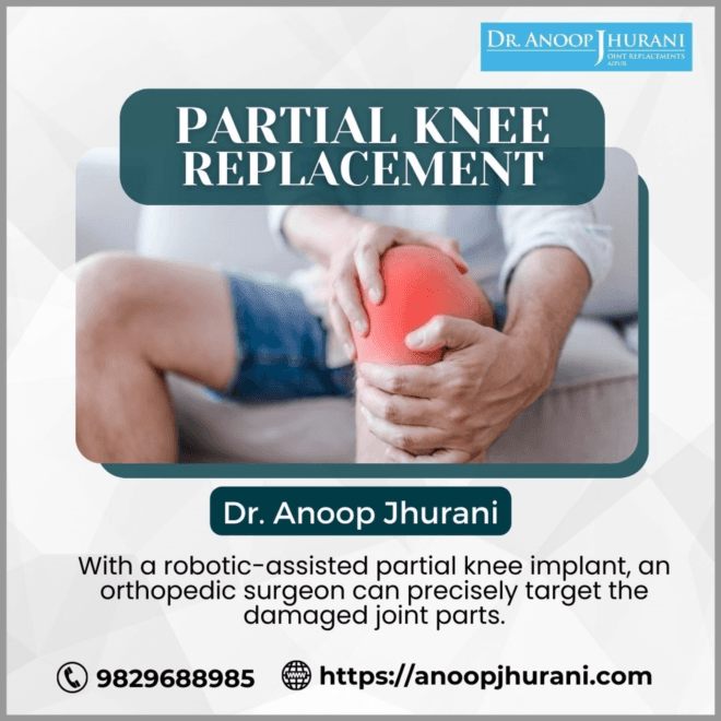  The Steps of a Partial Knee Replacement Procedure