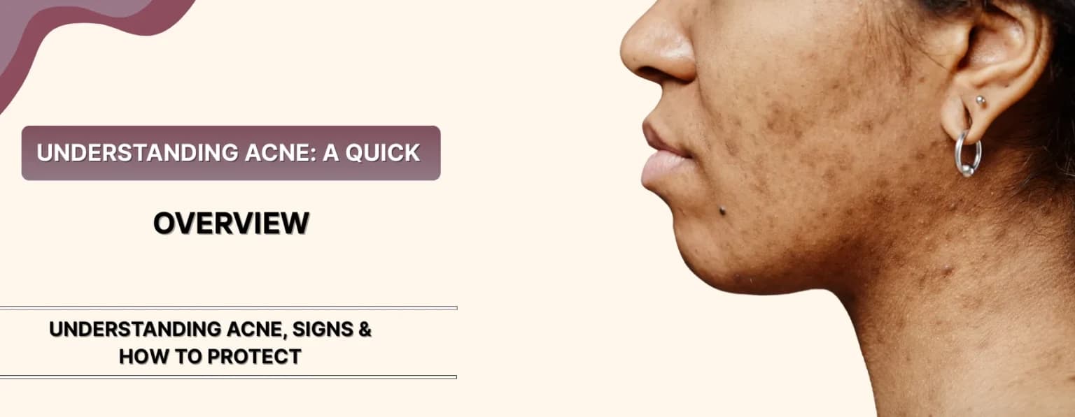 Can Acne Be Triggered by Long Screen Time & Blue Light?