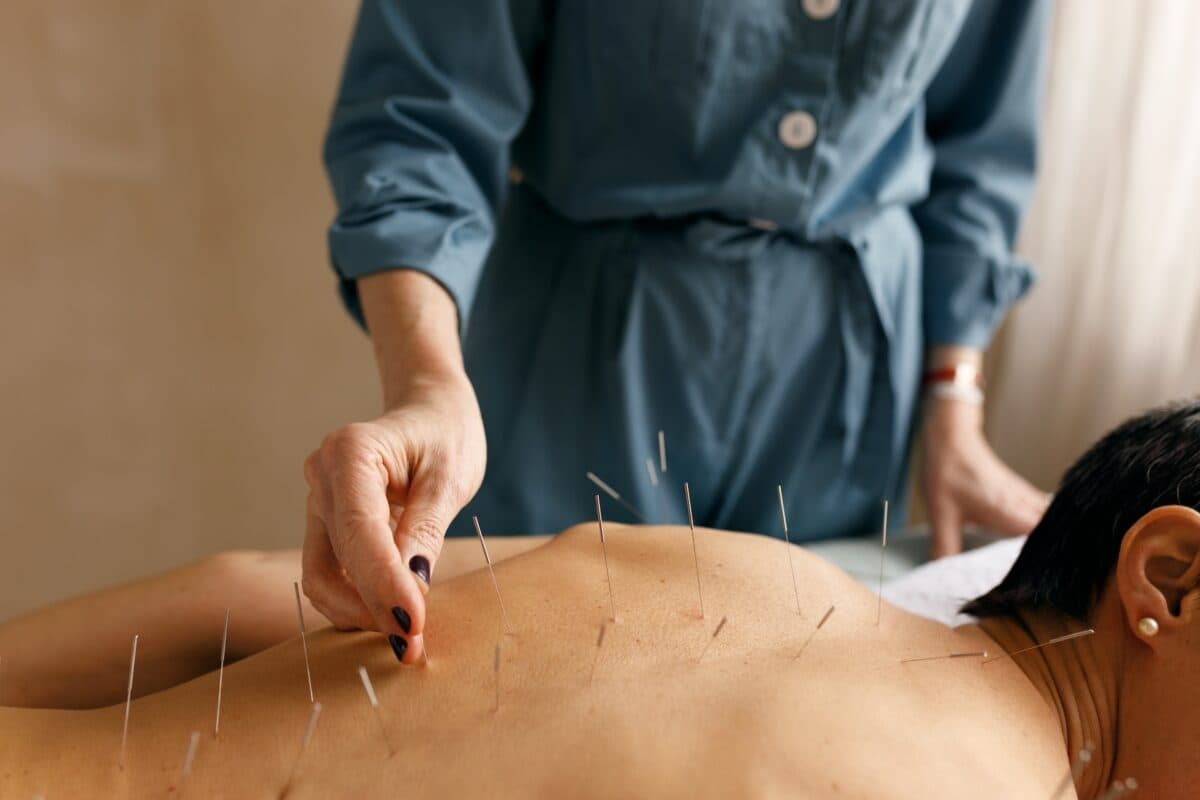 Choosing Acupuncture for Pain Management in Philadelphia