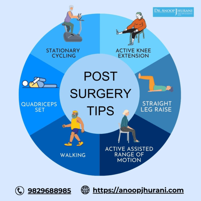 Post Knee and Hip Replacement Surgery Tips for a Speedy Recovery