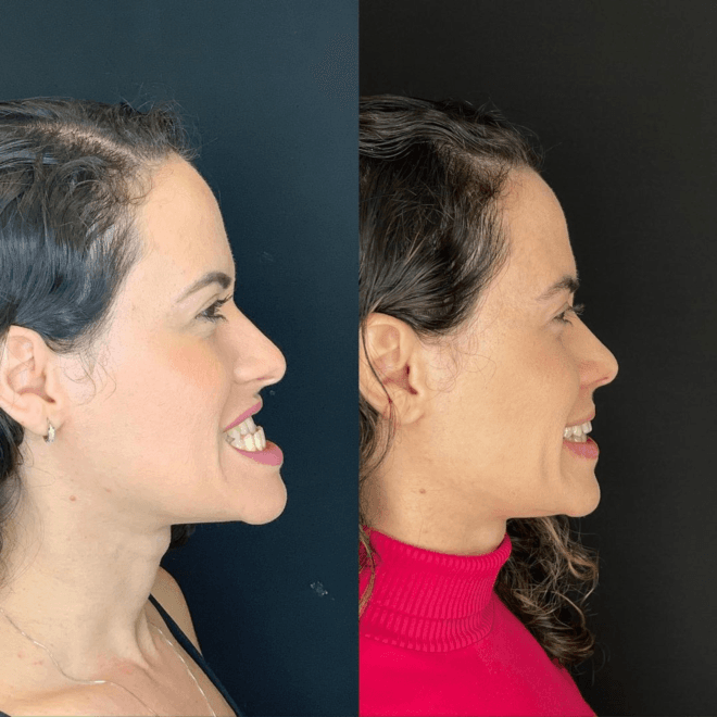 Drº Israel Vicente: Transformando Vidas Através da Cirurgia Ortognática