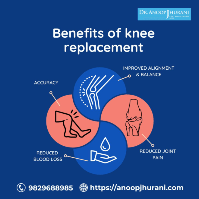 Benefits of knee replacement 