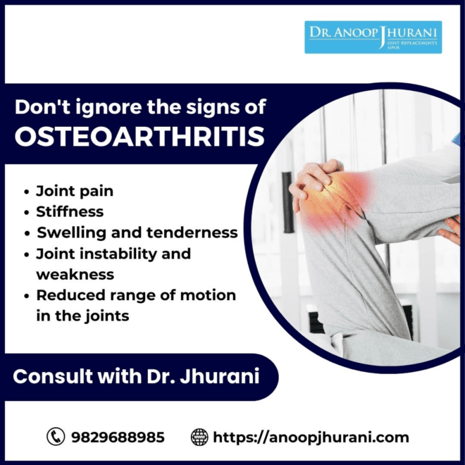  The Signs of Osteoarthritis