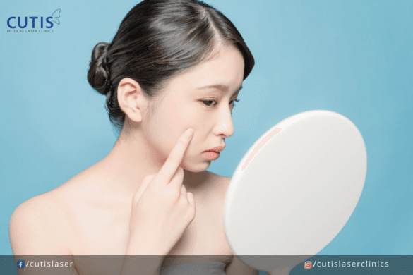 Does Your Skin Feel Dry and Tight After Washing? Here’s Why