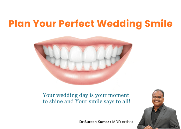 PlanYour Perfect Wedding Smile Advice from Dr B Suresh Kumar