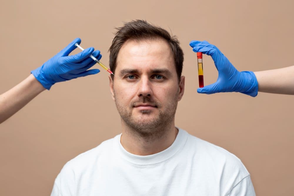 A Simple Guide to PRP Hair Treatment in Delhi