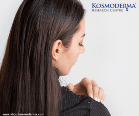 Dusting Away Dandruff For Good – How To Remove Dandruff from Hair: A Complete Guide