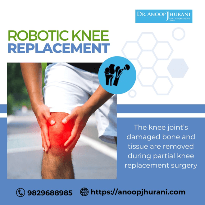 Advantages of Partial Knee and Ligament-Preserving Knee Replacement