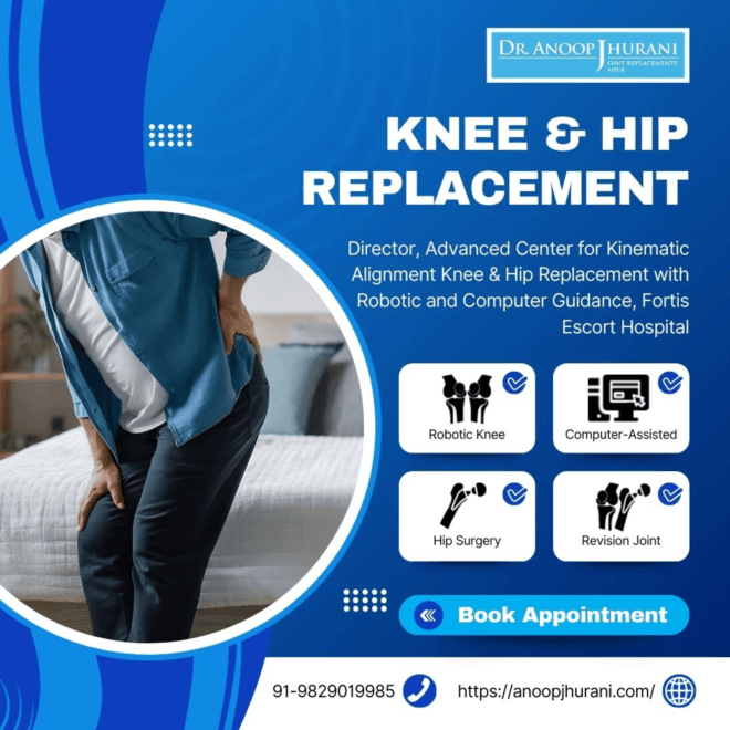 Fast Recovery Tips After Knee Arthroplasty Surgerys