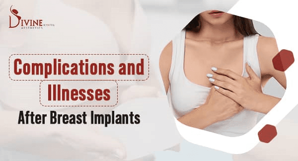 What Are the Complications and Illnesses After Breast Implants?