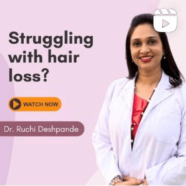 Best Homeopathy Treatment for Hair loss in Dubai