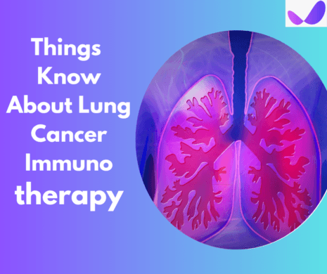 5 Things You Should Know About Lung Cancer Immunotherapy