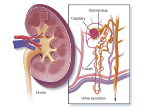 What is the most common initial symptom of Acute Kidney Failure?
