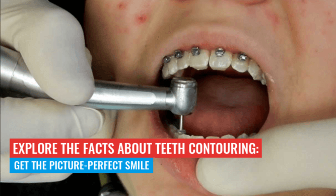 Explore the Facts about Teeth Contouring: Get the Picture-Perfect Smile