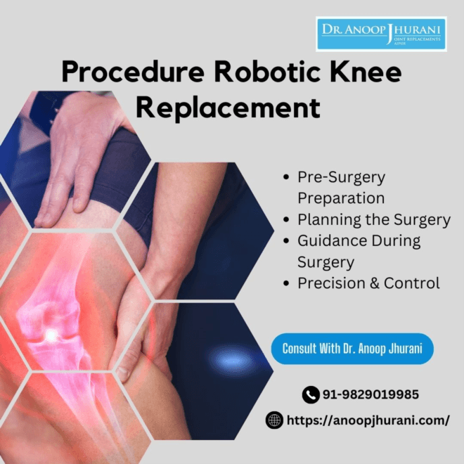  The Procedure Robotic Knee Replacement 