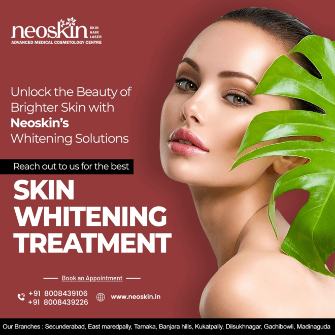 Laser skin whitening in Hyderabad | Neoskin Clinic