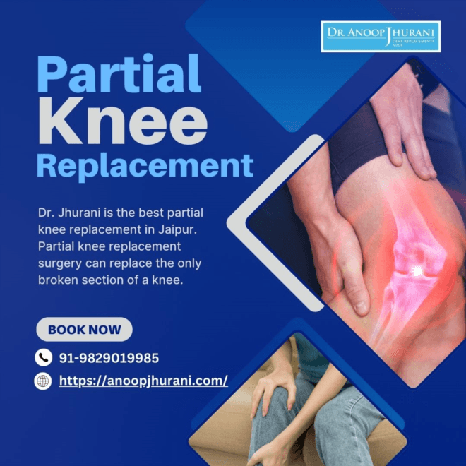  Benefits of Robotic Partial Knee Replacement