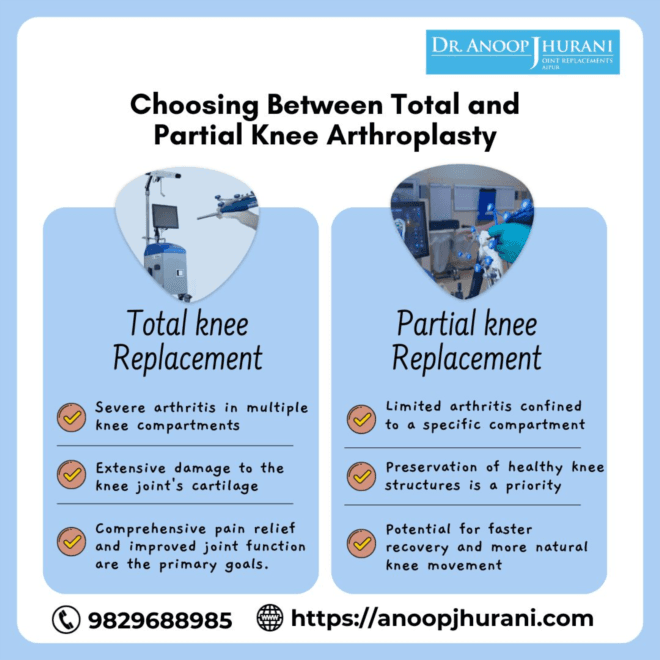 Choosing Between Total and Partial Knee Arthroplasty