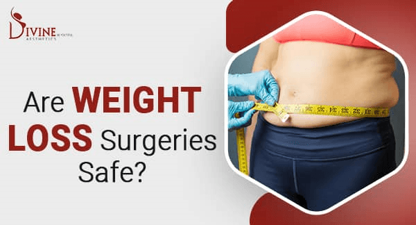 Are Weight Loss Surgeries Safe?