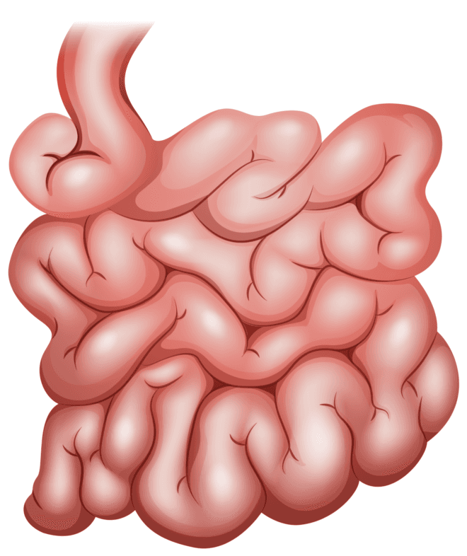 Intestinal transplant 